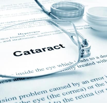 cataract assessment