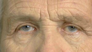 Benefits Of Finding Cataract Surgery Near Me