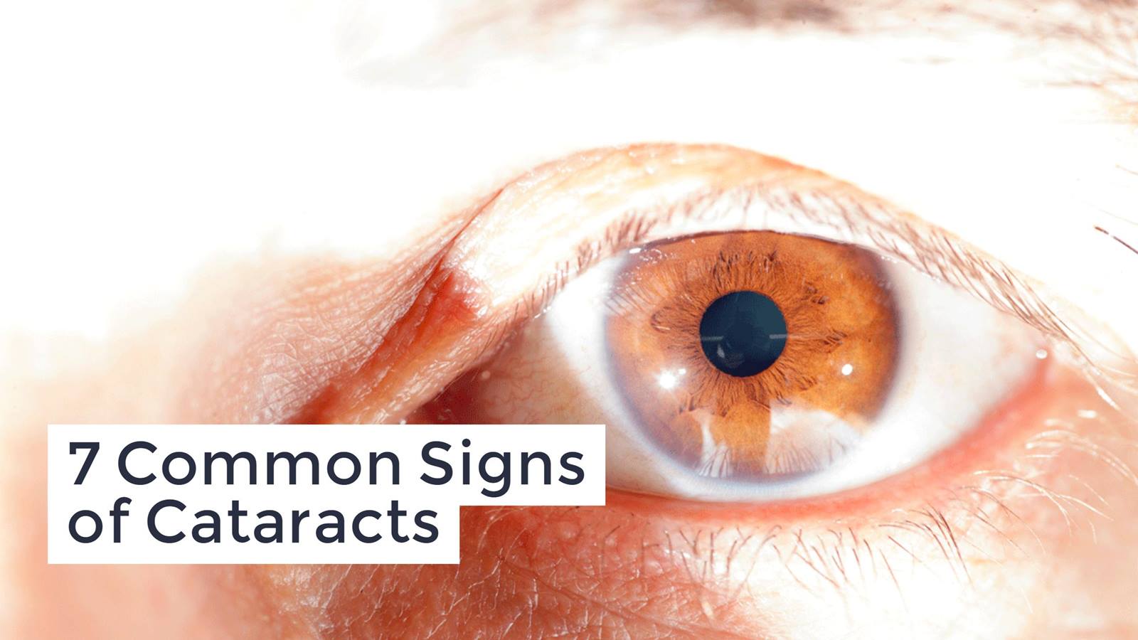 Different Symptoms of Cataracts