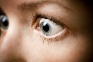 How Common Are Early Onset Cataracts?
