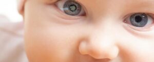 juvenile cataracts