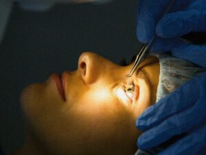 Atopic Cataract: What You Need to Know