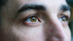 How to Identify And Treat a Punctate Cataract