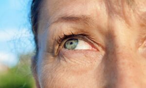 A Comprehensive Guide to Right Eye Cataract