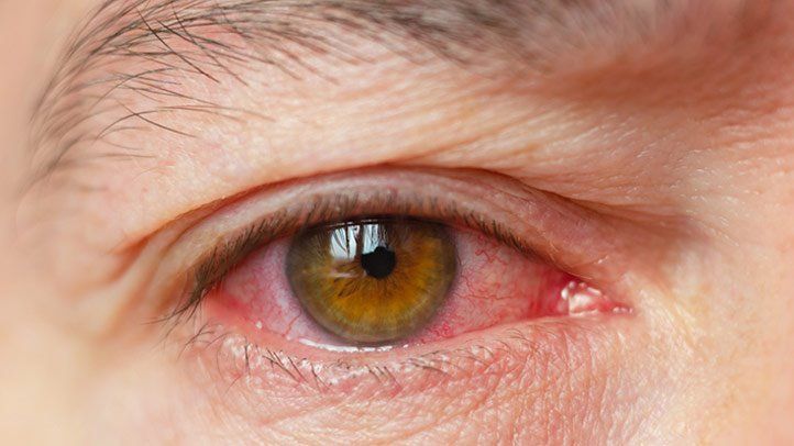 Are There Any Complications Associated with Phacoemulsification?