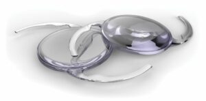 Toric IOL: Detailed Guide On This Type of Lens